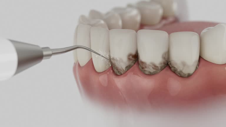 Reliable Wisdom Tooth Removal contractor in White County County, TN by Dentist Open Now